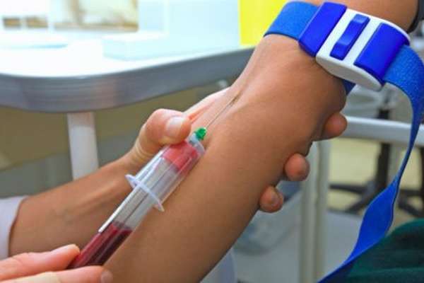 Какой должна быть норма СРБ в биохимическом анализе крови человека?