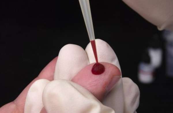 Как проводится измерение эритроцитов в крови человека и когда нужно проводить диагностику и лечение?