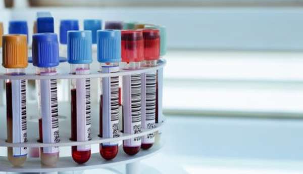 Показания к проведению анализа крови на билирубин, нормы и отклонения