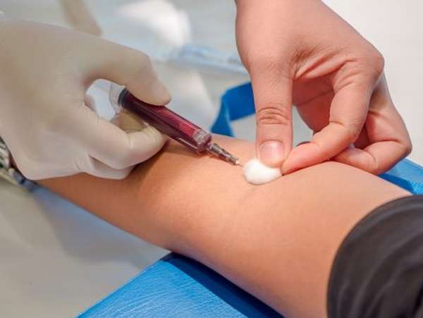 Расшифровка : что такое АЧТВ в анализе крови, зачем проводят исследование