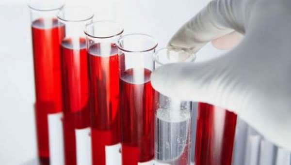 Как выполняется расшифровка результатов биохимического анализа крови у взрослых? Нормы в таблице