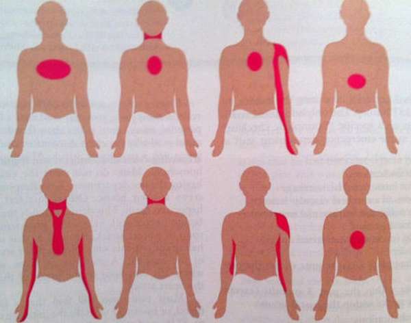 Причины болей в левой части грудной клетки, диагностика, лечение и профилактика