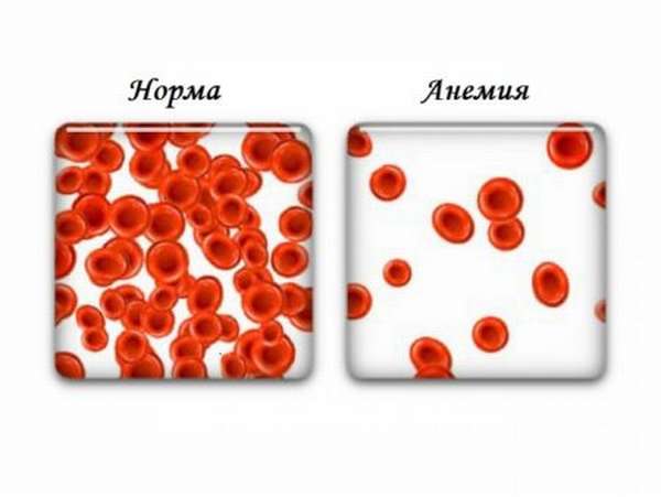 Уровень гемоглобина в крови взрослых и детей: за что отвечает и каковы нормы показателя?