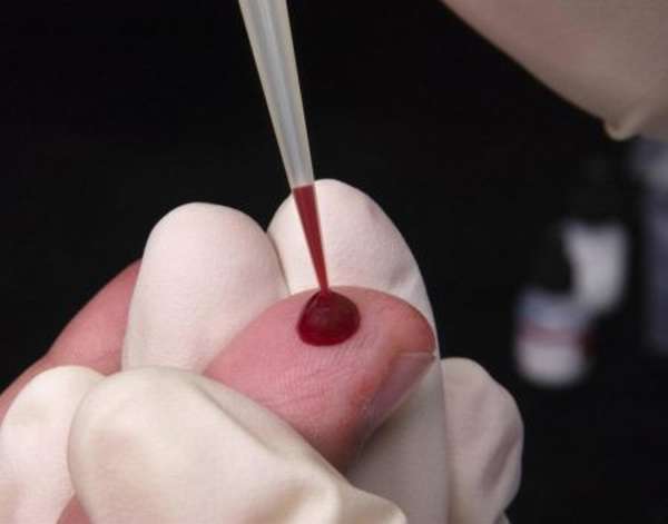 Общий анализ крови время кровотечения thumbnail