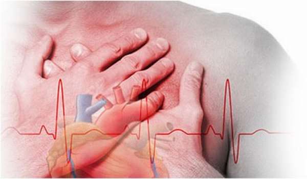 Понятие дилатационной кардиомиопатии, как проявляется, симптомы и способы эффективной терапии
