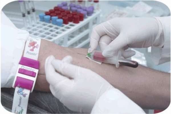 Биохимический анализ крови и причины отклонений ЩФ в его показателях, возможные заболевания