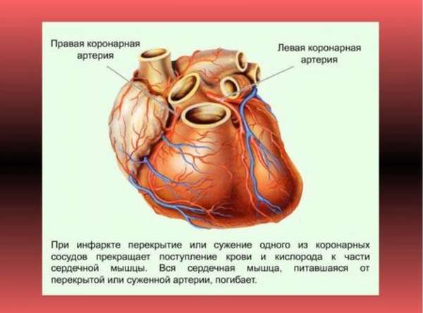 Виды остановки сердца и основные причины приступа у потерпевшего