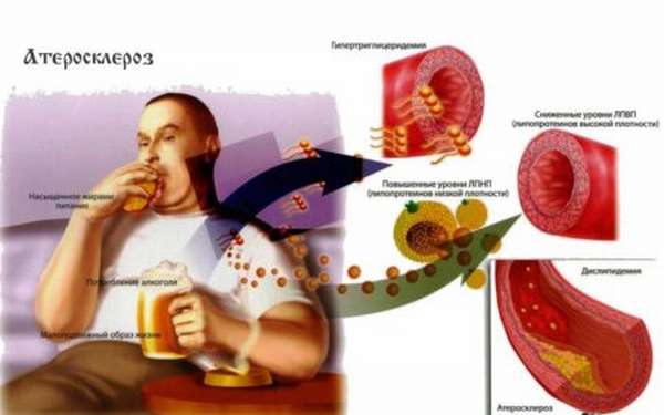 Что нужно знать о диете при атеросклерозе сосудов головного мозга и шеи? Какие продукты полезны?