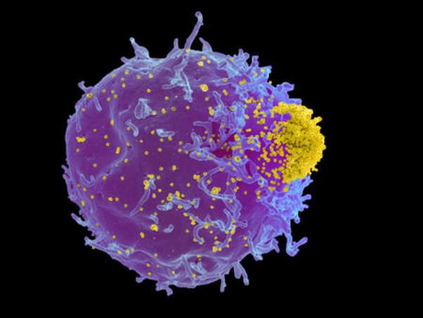 Условия для иммунофенотипирования лимфоцитов для чего его проводят?