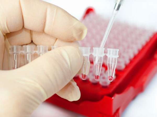Роль антител к тромбоцитам и причины их количественного отклонения от нормы