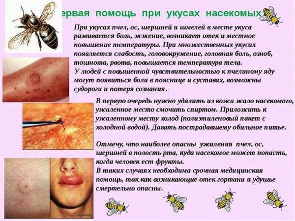 Аллергия на укусы насекомых: причины, симптомы и лечение