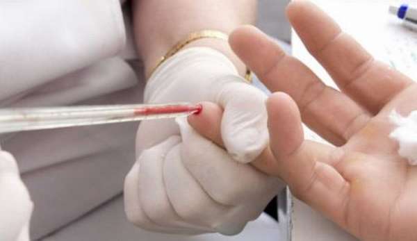 Сдача общего анализа крови: правила подготовки и проведение процедуры