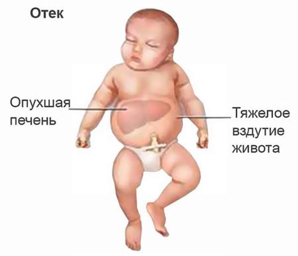 Определение совместимости групп крови для зачатия ребенка, таблица для определения данного показателя, возможные риски при несовместимости