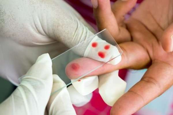 Общий анализ крови: сколько времени готовят результаты исследования