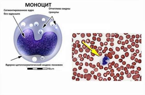В чем причина пониженных моноцитов в крови, способы лечения