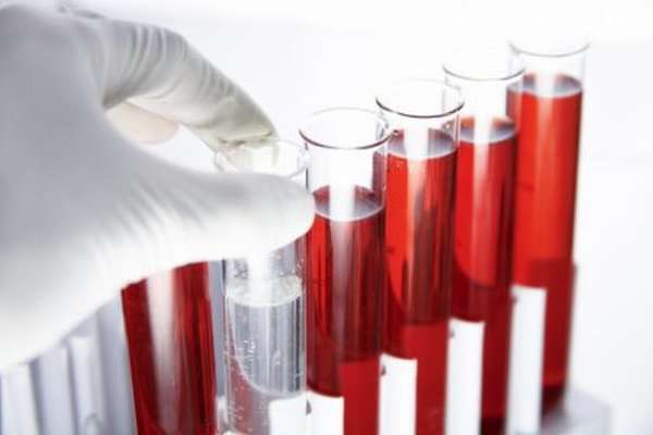 Понятие микроцитоза, и как он отображается в общем анализе крови больного?