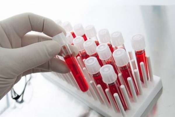 Почему назначают и кому рекомендуют сдавать анализы крови на АЛТ?