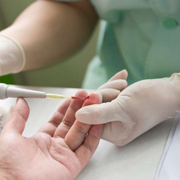 Общий анализ крови из вены или из пальца чем отличается ребенку thumbnail