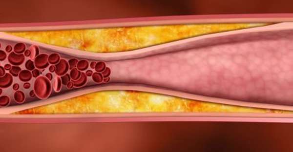 Таблица норм холестерина в крови у мужчин по возрасту. Как меняется его содержание с годами?