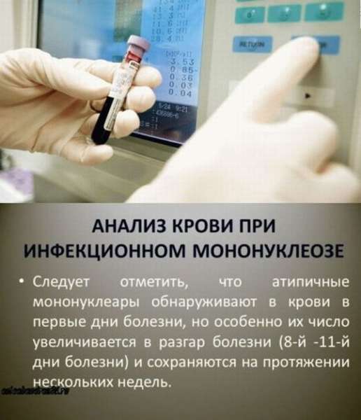Общий анализ крови с мононуклеарами расшифровка thumbnail