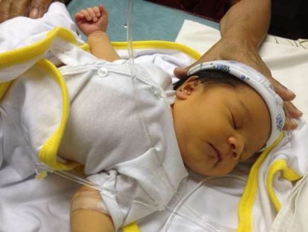 Назначение анализа на билирубин у новорожденных, для чего он нужен?