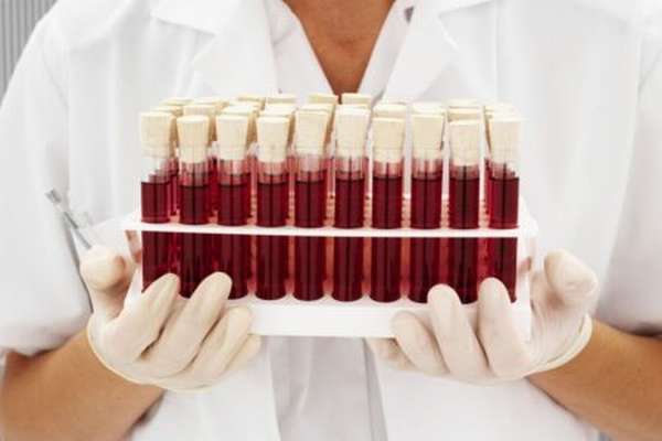 Как определить группу крови человека по системе АВО, суть метода и его важность