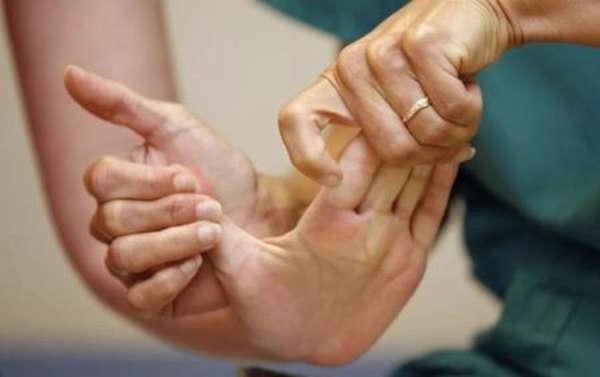 Как восстановить руку после перенесенного инсульта реабилитация в медицинском центре и дома