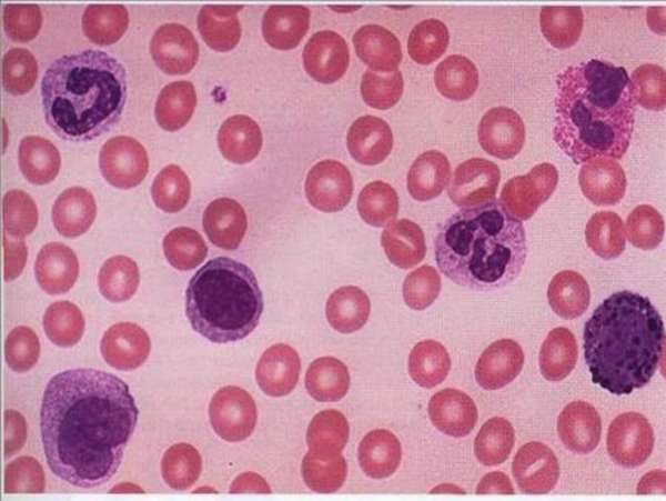 Какие должны быть нормы лейкоцитов в крови здорового ребенка, подростка и взрослого человека?