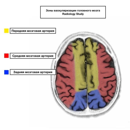 Причины возникновения гипоплазии артерии головного мозга, методы диагностики, лечение и симптоматика