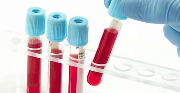 Вопросы подготовки к сдаче анализов крови на гормоны. Особенности питания и поведения