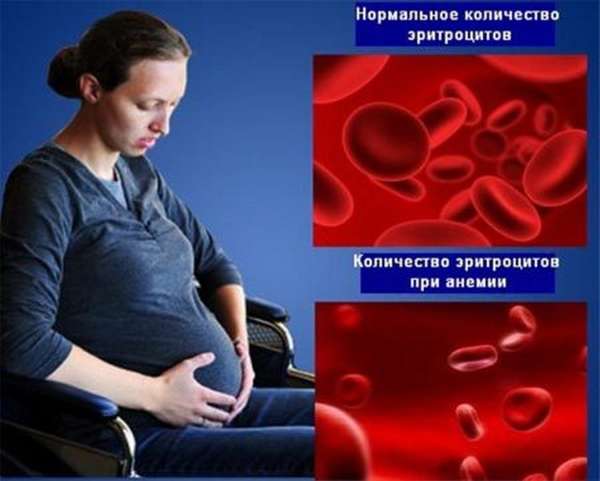 Причины нехватки воздуха при беременности, стоит ли паниковать и меры профилактики