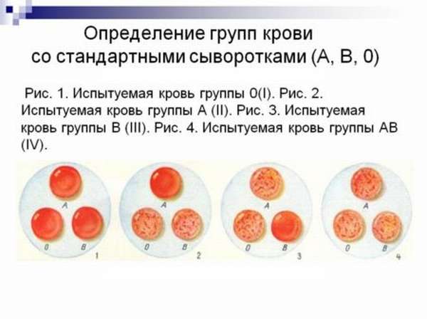 Как определяют группу крови стандартными сыворотками, методы и особенности проведения