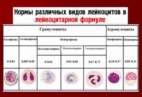 Отклонение лейкоцитов в анализе крови, причины и симптомы, правила для правильного забора крови