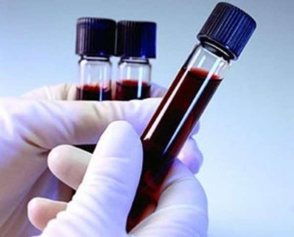 Аст анализ крови подготовка к сдаче thumbnail