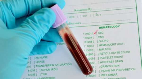 В чем заключаются отличия общего анализа крови от клинического, расшифровка данных