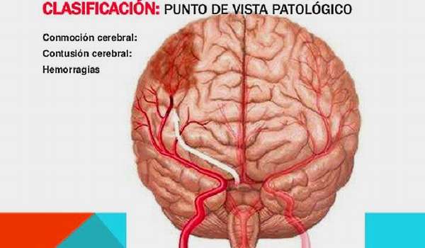 Церебральная атрофия головного мозга: диагностика, лечение, профилактика