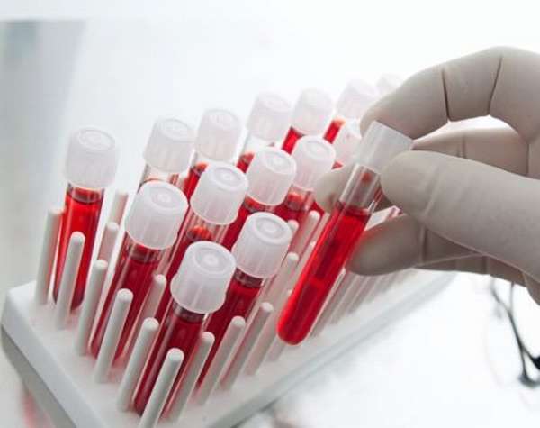 Для чего сдают анализ на PH крови, и какие патологии он помогает диагностировать?