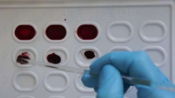 Как определяют группы крови с помощью цоликлонов, и насколько это достоверно?