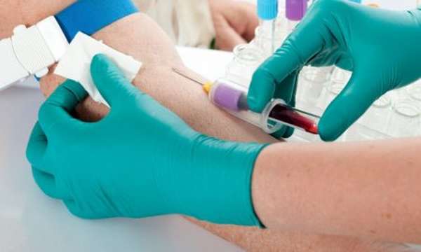Влияние процесса подготовки к сдаче крови на результаты биохимического анализа крови