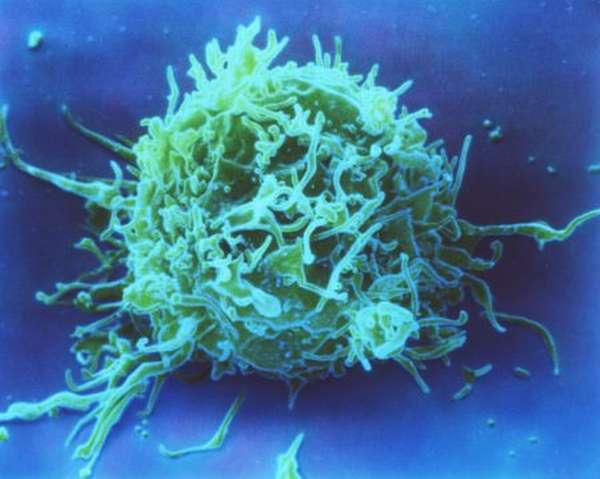 Насколько опасны пониженные лимфоциты в организме человека?