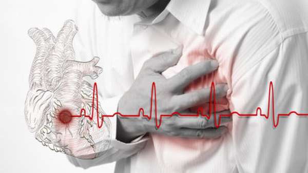 Скрытая опасность инфаркта перенесенного на ногах, как вовремя распознать болезнь?