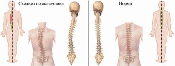Что делать при боли в грудине посередине, отдающей в спину? Какие меры нужно предпринять?