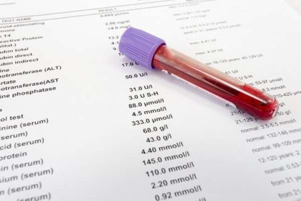Как в анализах крови обозначаются лейкоциты, разновидности клеток, методы определения