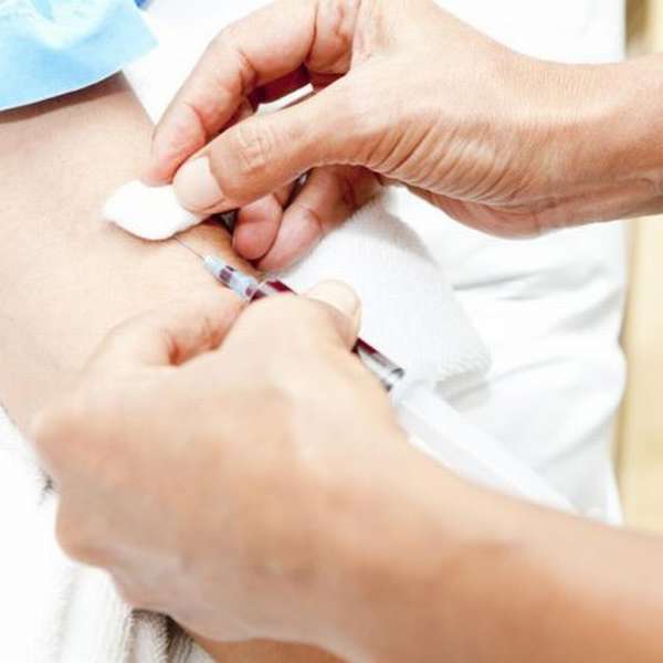 Как в лаборатории диагностируют сифилис при помощи анализа крови РМП?