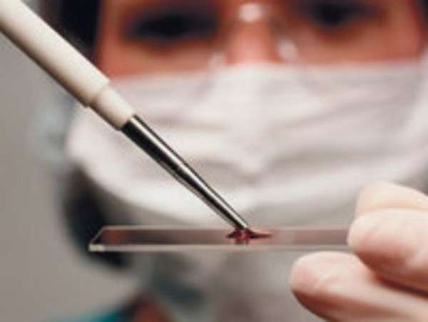 В чем отличие общего анализа крови из вены или из пальца, правила проведения процедур