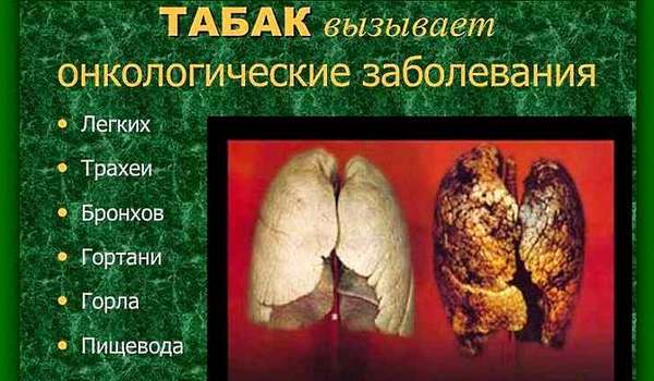 О вреде курения при язвенной болезни