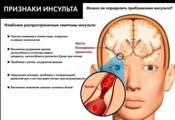 Какие причины провоцируют развитие тромба в головном мозге, характерные симптомы и лечение