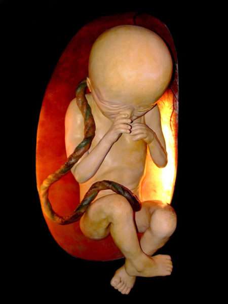 Необходимость аборта при отрицательном резус-факторе: к каким осложнениям приводит и можно ли его делать при низком гемоглобине?