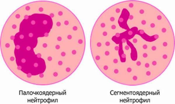 Классификация видов лейкоцитов, основные функции клеток, нормы и отклонения в анализе крови