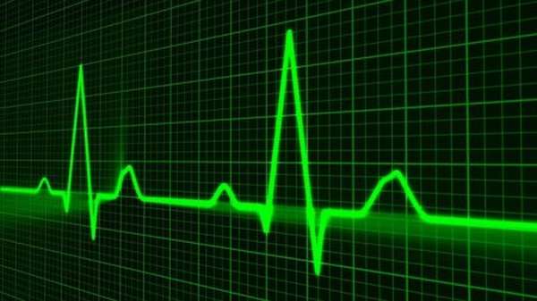 Как правильно и за какое время нужно подсчитать пульс при аритмии сердца?